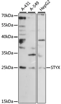 STYX Polyclonal Antibody - image 1