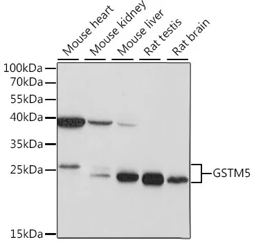GSTM5 Polyclonal Antibody - image 1