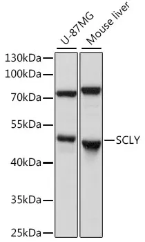 SCLY Polyclonal Antibody - image 1
