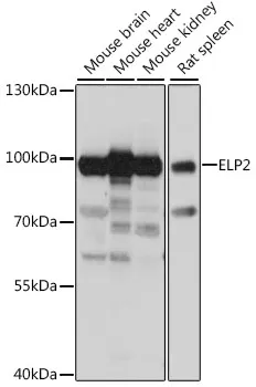 ELP2 Polyclonal Antibody - image 1