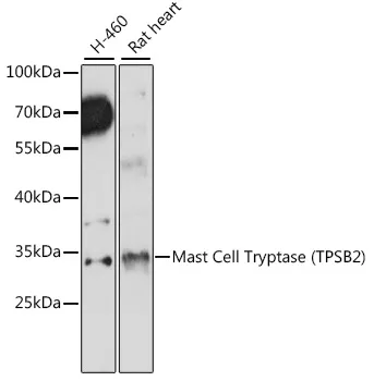Mast Cell Tryptase Polyclonal Antibody - image 1