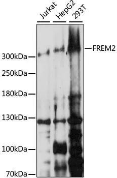 FREM2 Polyclonal Antibody - image 1