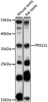 PRSS21 Polyclonal Antibody - image 1