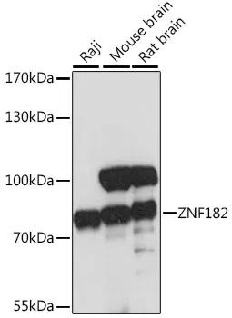 ZNF182 Polyclonal Antibody - image 1