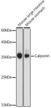 Calponin Polyclonal Antibody - image 1