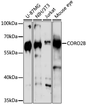 CORO2B Polyclonal Antibody - image 1