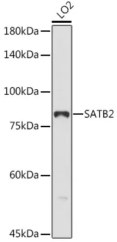 SATB2 Polyclonal Antibody - image 1