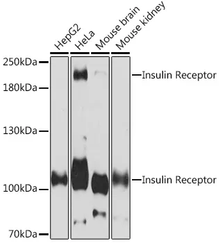 Insulin Receptor Polyclonal Antibody - image 1