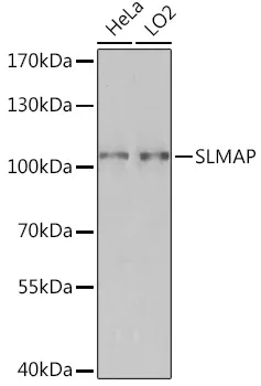 SLMAP Polyclonal Antibody - image 1