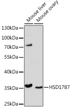 HSD17B7 Polyclonal Antibody - image 1