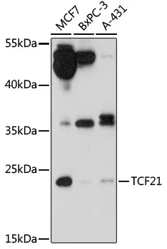 TCF21 Polyclonal Antibody - image 1