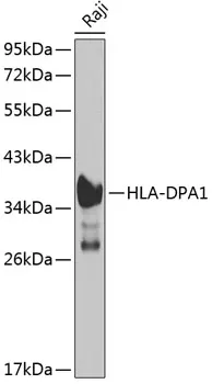 HLA-DPA1 Polyclonal Antibody - image 1