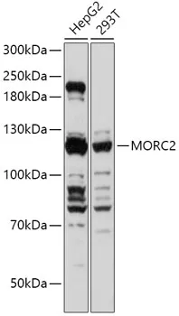 MORC2 Polyclonal Antibody - image 1