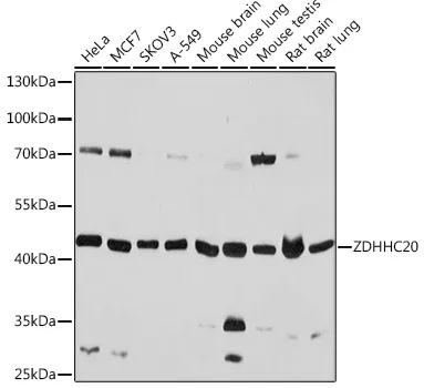 ZDHHC20 Polyclonal Antibody - image 1