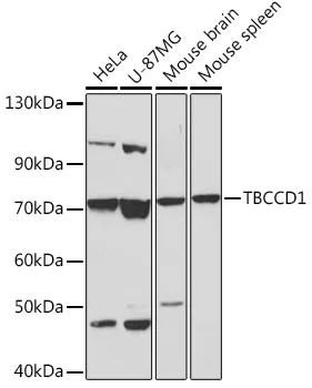 TBCCD1 Polyclonal Antibody - image 1
