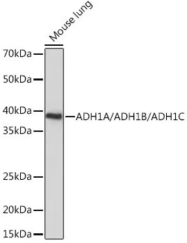 ADH1A/ADH1B/ADH1C Polyclonal Antibody - image 1