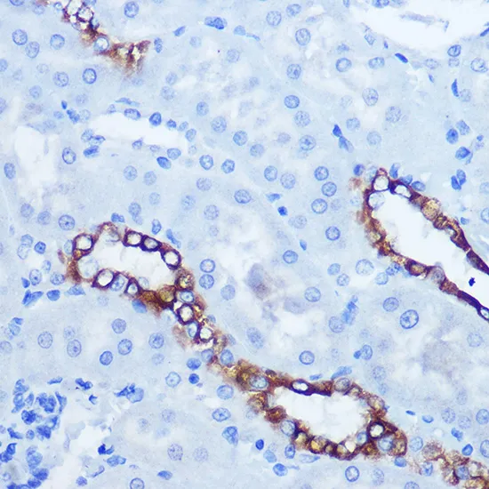 EPHA3/EPHA4/EPHA5 Polyclonal Antibody - image 1