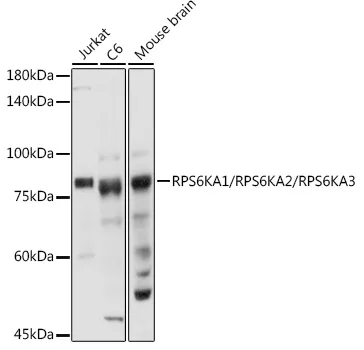 RPS6KA1/RPS6KA2/RPS6KA3 Polyclonal Antibody - image 1