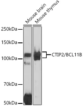 CTIP2/BCL11B Polyclonal Antibody - image 1