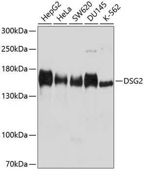 DSG2 Polyclonal Antibody - image 1