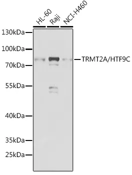 TRMT2A/HTF9C Polyclonal Antibody - image 1