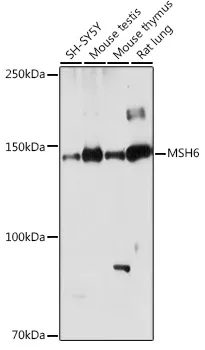MSH6 Polyclonal Antibody - image 1