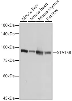(KO Validated) STAT5B Polyclonal Antibody - image 1