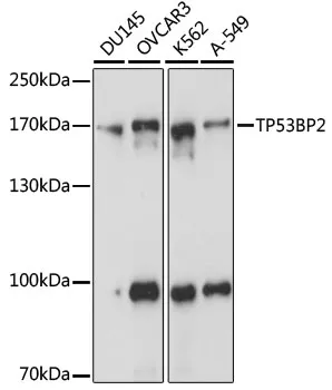 TP53BP2 Polyclonal Antibody - image 1