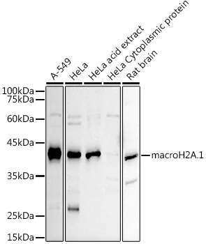 macroH2A.1 Polyclonal Antibody - image 1