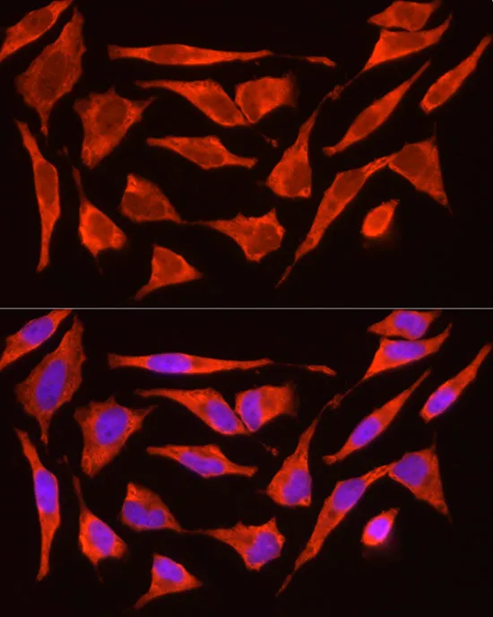 POMC Polyclonal Antibody - image 1