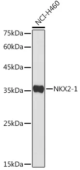 NKX2-1 Polyclonal Antibody - image 1