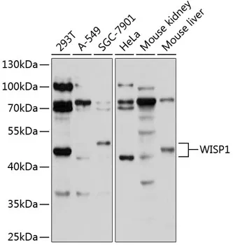 WISP1 Polyclonal Antibody - image 1