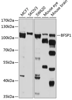 BFSP1 Polyclonal Antibody - image 1