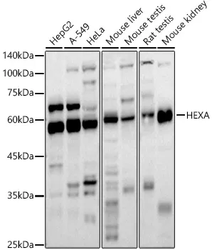 HEXA Polyclonal Antibody - image 1