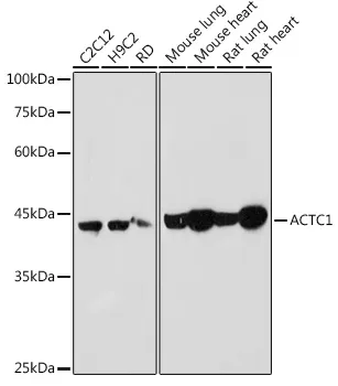ACTC1 Polyclonal Antibody - image 1
