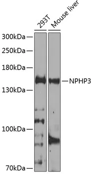 NPHP3 Polyclonal Antibody - image 1