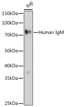 Human IgM Polyclonal Antibody - image 1