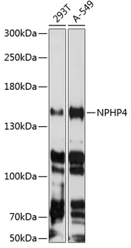 NPHP4 Polyclonal Antibody - image 1