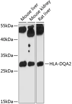 HLA-DQA2 Polyclonal Antibody - image 1