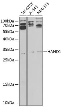 HAND1 Polyclonal Antibody - image 1
