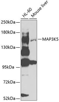 MAP3K5 Polyclonal Antibody - image 1