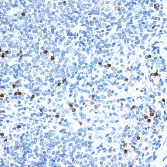 MMP9 Polyclonal Antibody - image 1