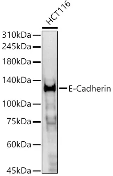 E-Cadherin Polyclonal Antibody - image 1