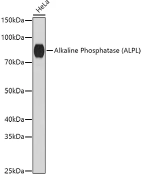 Alkaline Phosphatase (ALPL) Polyclonal Antibody - image 1