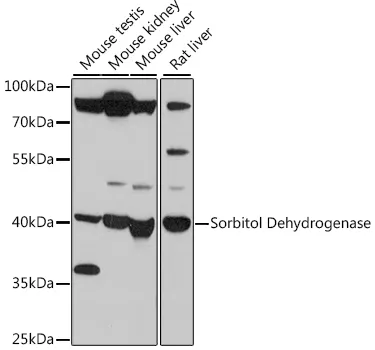 Sorbitol Dehydrogenase Polyclonal Antibody - image 1