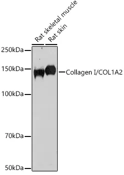 Collagen I/COL1A2 Polyclonal Antibody - image 1