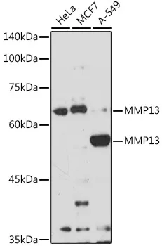 (KO Validated) MMP13 Polyclonal Antibody - image 1