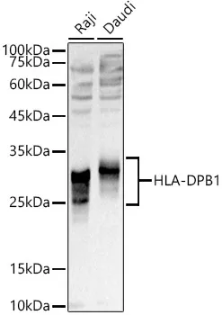 HLA-DPB1 Polyclonal Antibody - image 1