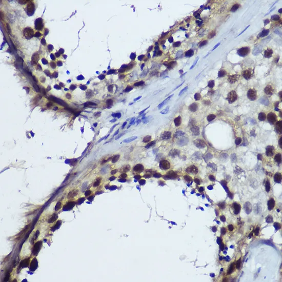 TET1 Polyclonal Antibody - image 1
