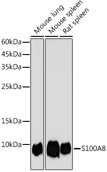 S100A8 Polyclonal Antibody - image 1